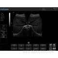 Laptop Ultrasound For Pregnant Ragdoll Cat